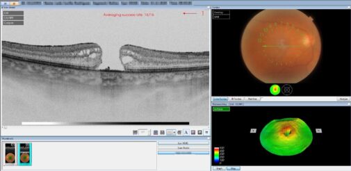 {{brizy_dc_image_alt imageSrc=