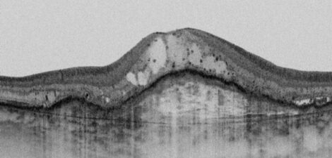 Ein Schwarz-Weiß-Foto eines Berges. {{brizy_dc_image_alt imageSrc=