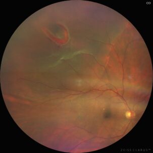 Ein Bild eines Auges mit rotem Licht darin. {{brizy_dc_image_alt imageSrc=