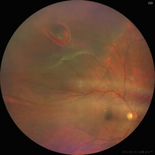 {{brizy_dc_image_alt imageSrc=